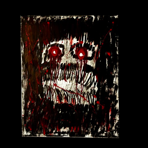 Visceral Pain