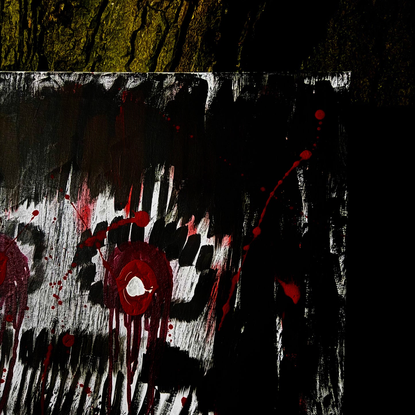 Visceral Pain