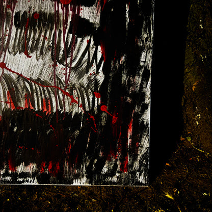 Visceral Pain